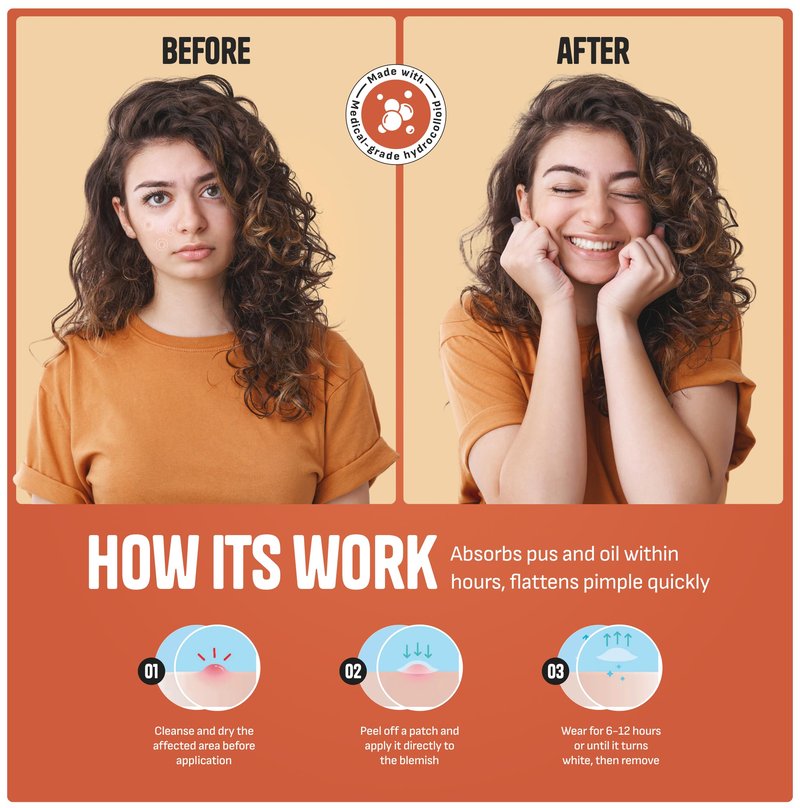 GoGleefy Pimple Patches for Face – Day & Night Acne Patches for Fast Healing, Skin Clarity – Invisible Hydrocolloid Patches, Waterproof Spot Treatment – All Skin Types Zit Patches of 60/120/180