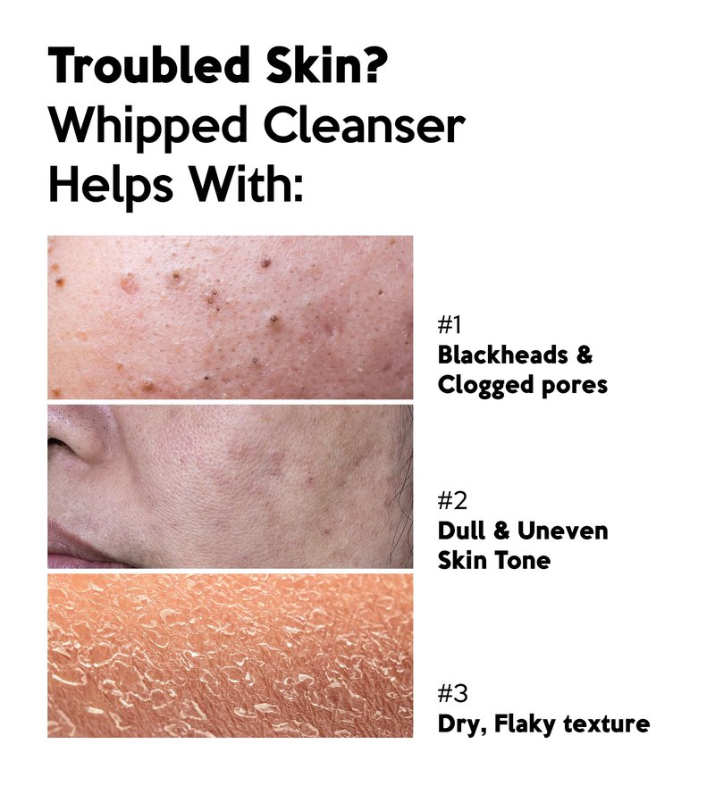 Troubless CLEAR PLUS Smooth Whipped Cleanser – Korean Skin Care Mask-to-Foam Facial Cleanser w/Vitamin C, Mung Bean, Kaolin Clay & PHA – Pore-Refining & Hydrating Face Wash (2.70 fl oz)