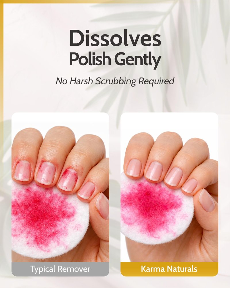 Karma Organic Nail Polish Remover Unscented- Non Toxic, Vegan, Cruelty Free, Acetone Free – Nails Strengthener for Fingernails – 4 fl. Oz