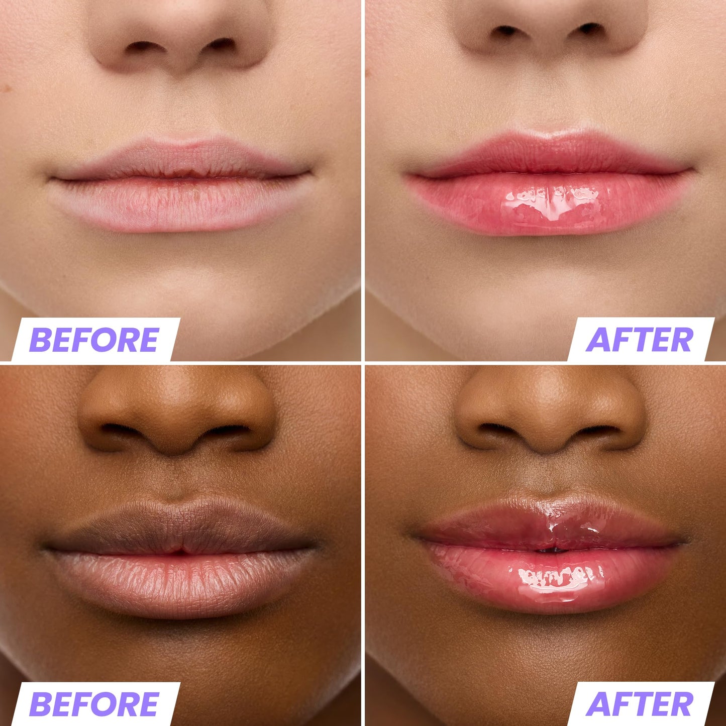 Wonderskin Lip Rehab Serum Oil (Kissed (2 Pack))