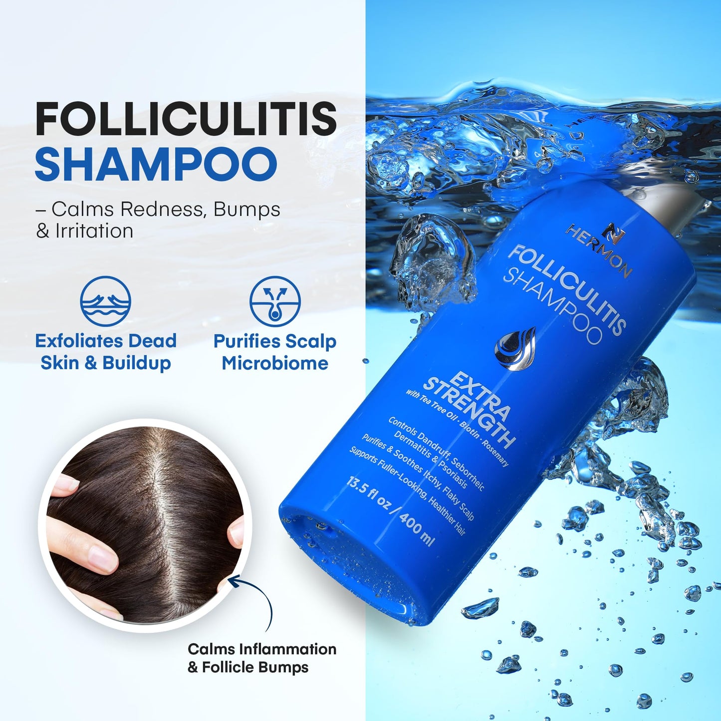 Hermon Folliculitis Treatment (2 Packs Folliculitis Shampoo)
