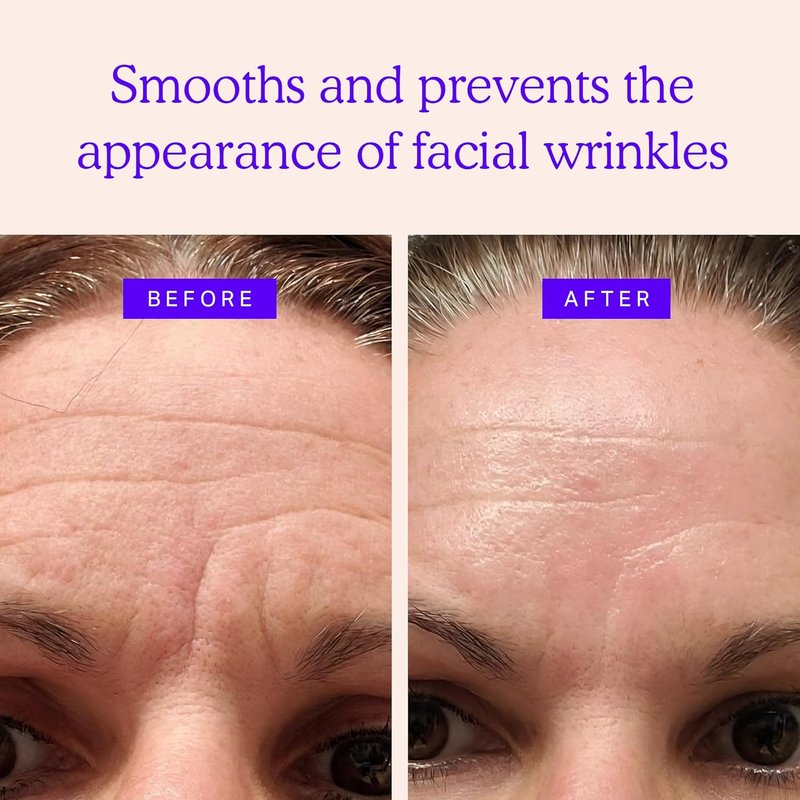 Face Wrinkle Patches - Mini Anti-Wrinkle Facial Patches for Eyes, Mouth & Forehead | 160 Non-Silicone Patches
