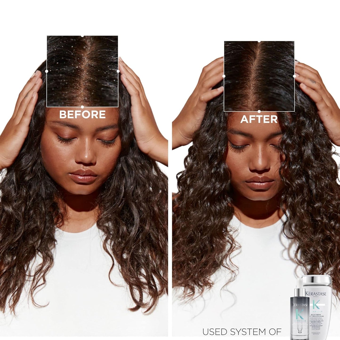 Kerastase Symbiose Antidandruff Hair Serum - Soothes & Hydrates Scalp | 3.04 Fl Oz