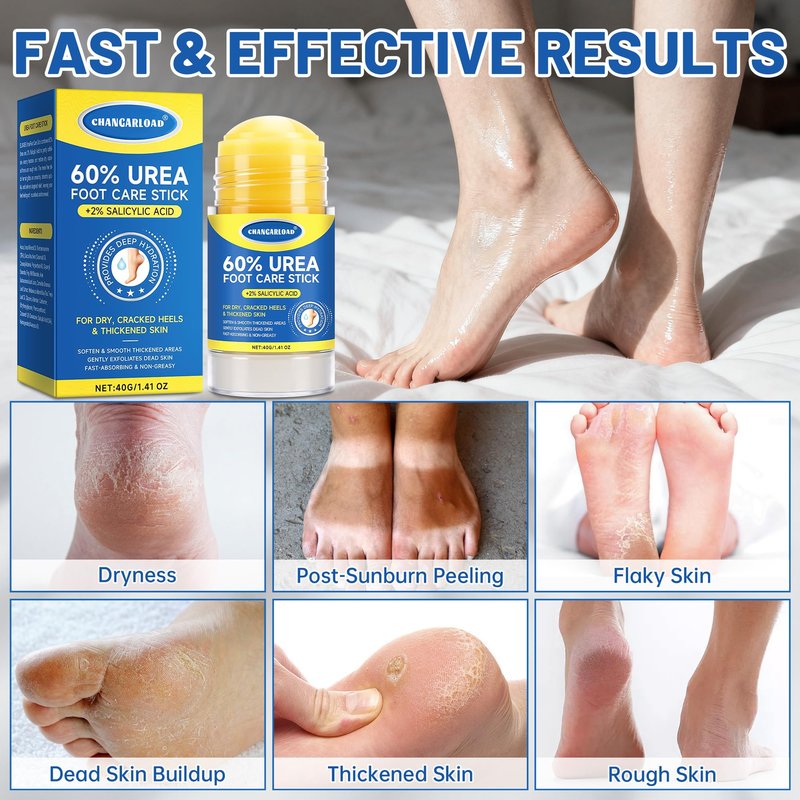 60% Urea + 2% Salicylic Acid Foot Cream–Ultra-Moisturizing Formula, Exfoliates Dead Skin, Softens Dry, Cracked Skin on Feet, Knees, Hands, Elbows. Helps soften callused, rough, or tender areas 1.41oz