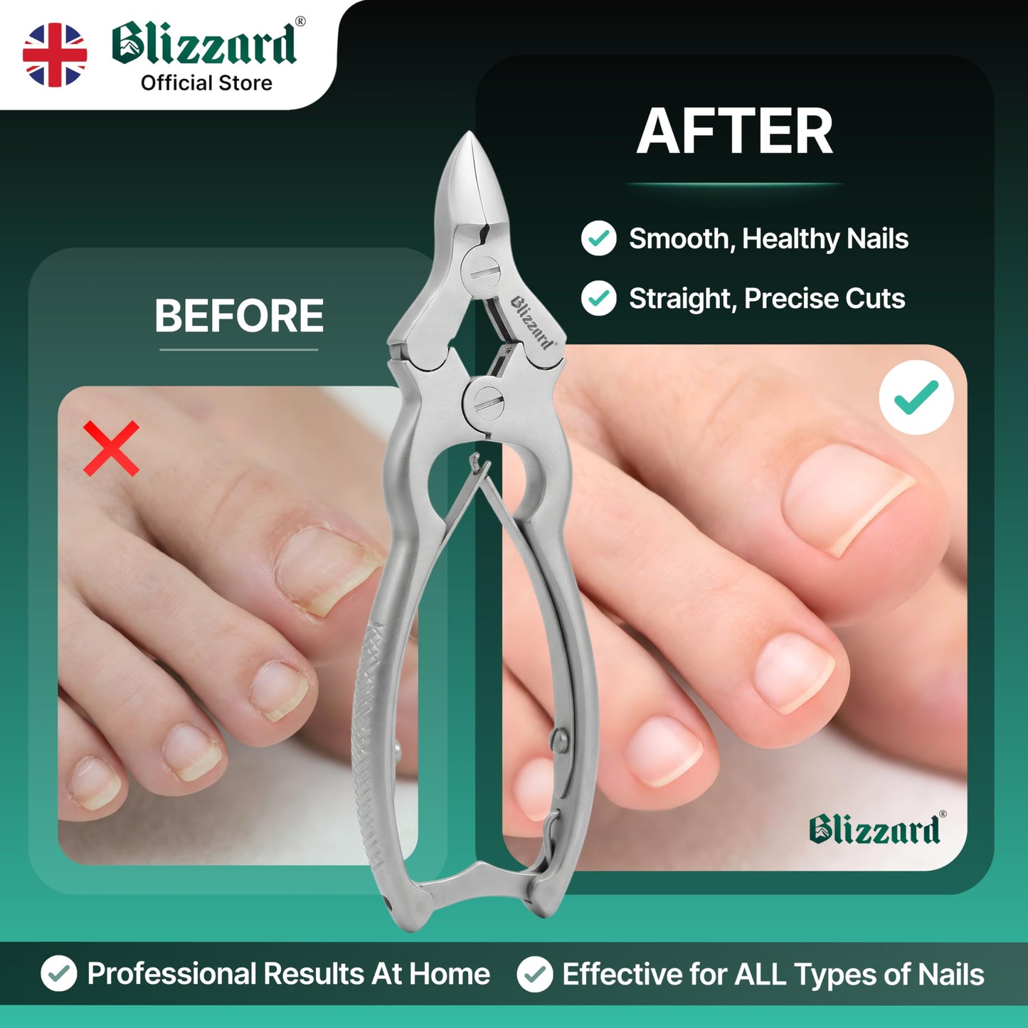 Blizzard Toenail Clippers - Podiatrist Toe Nail Clippers for Thick Nails for Seniors - German Forged Nail Cutter - Heavy Duty Double Action Nail Clippers for Men with Toenail File - 6" Double Spring