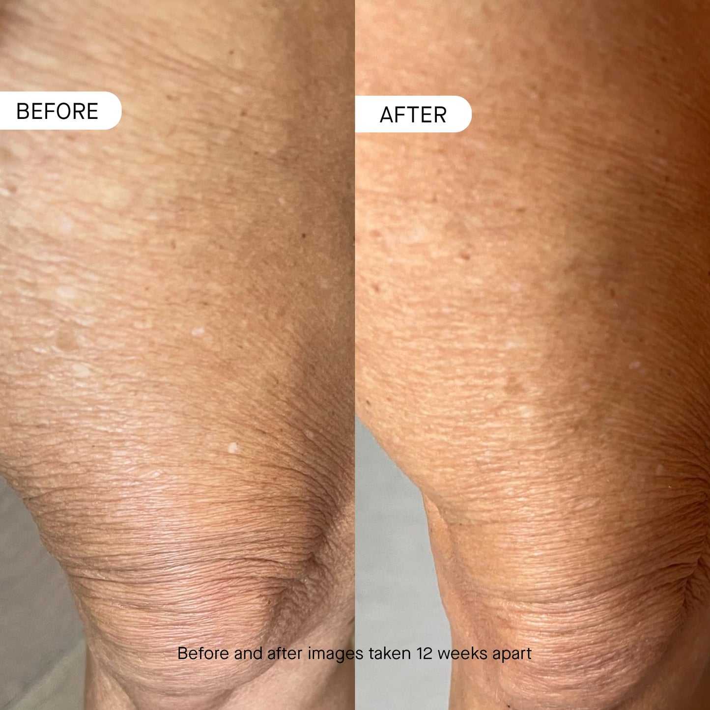 OneSkin OS-01 BODY Topical Supplement Moisturizer | Age Reversal, 8.45 Oz
