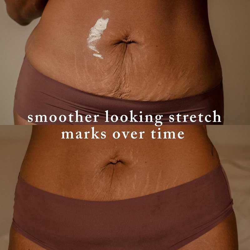 Stretch Mark Cream for Pregnancy - Moisturizing Belly Cream with Shea Butter & Macadamia Oil | 3.4 oz