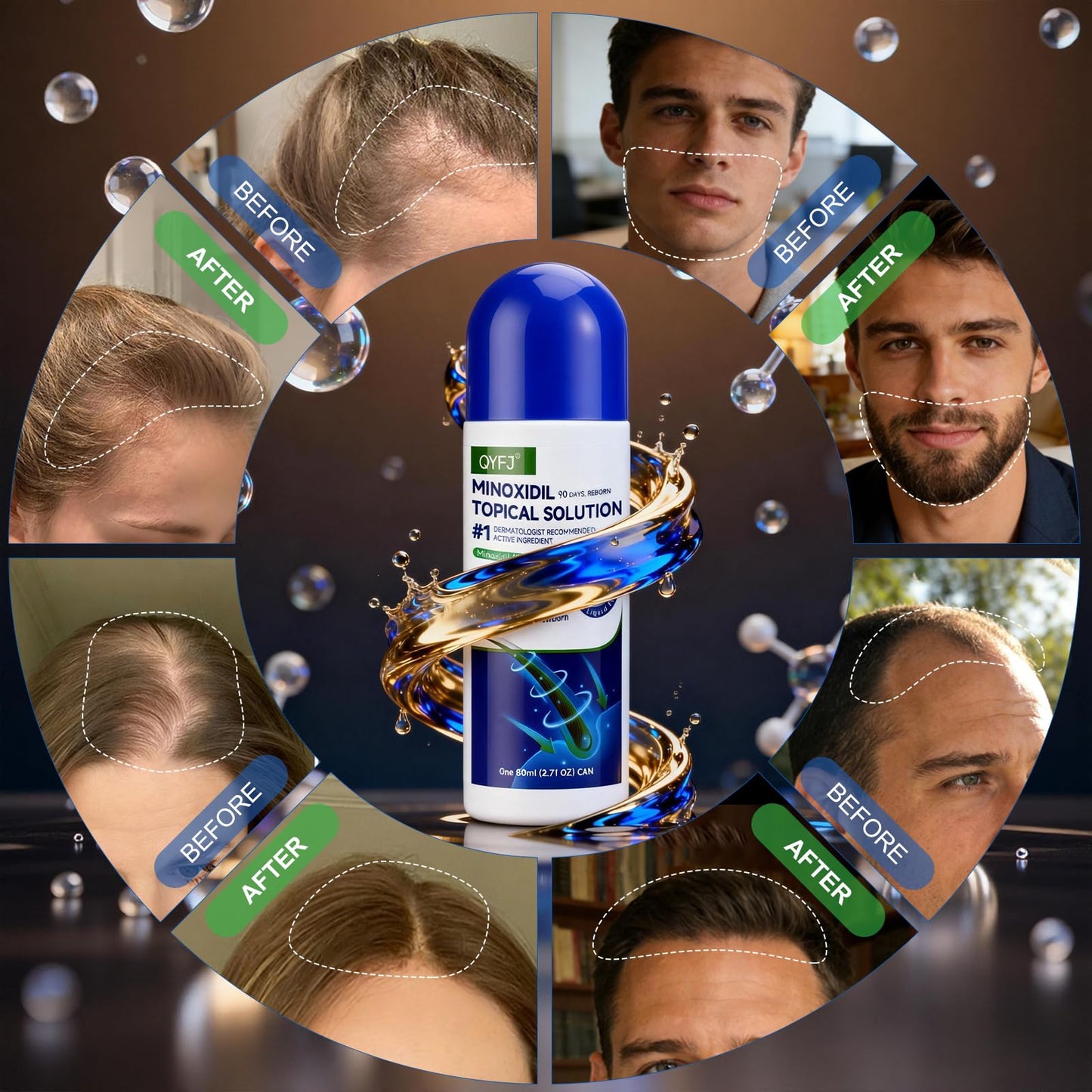 6 Pack 5% Minoxidil for Men and Women,Minoxidil Beard and Hair Growth Serum(Biotin-Infused) with Sponge Applicator for Thinning Hair and Sparse Beards,8-Month Supply 6 x 2.7 FL OZ