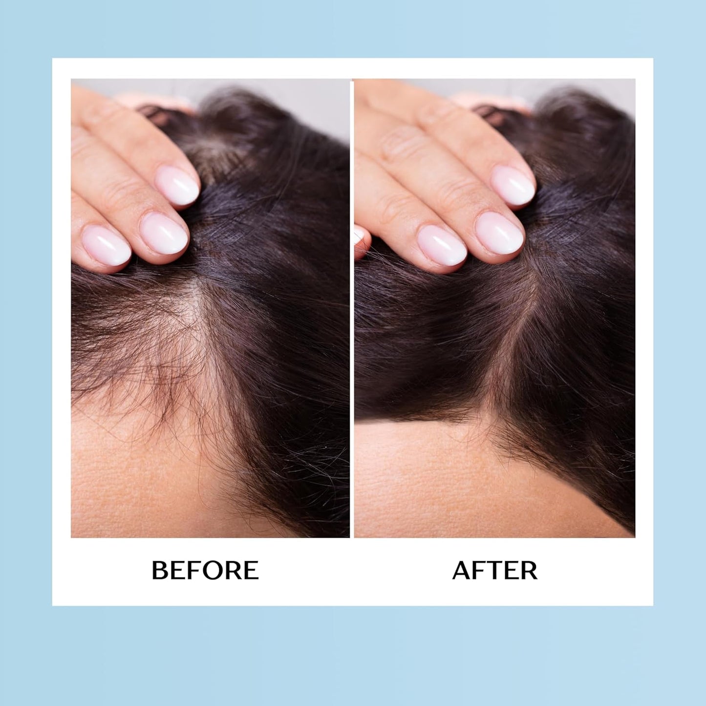 HairGain Unisex Hair Growth Supplement - 60 Tablets for Thicker, Healthier Hair