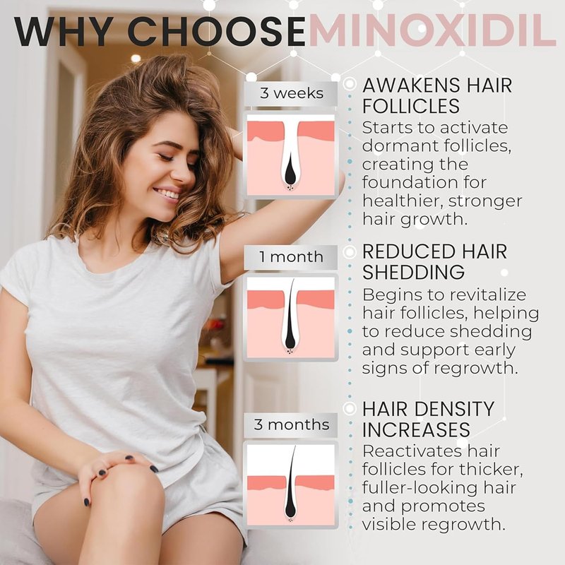 Minoxidil for Women - 5% Hair Growth Foam | Unscented, Dermatologist Recommended | 3-Month Supply