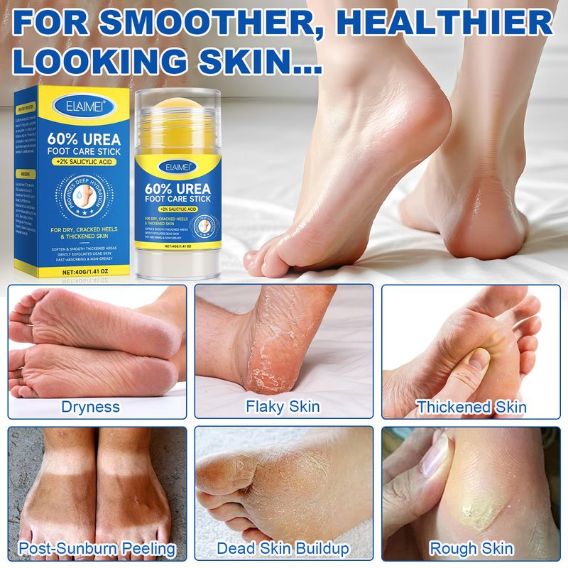 ConfidMiss Foot Care Stick with 60% Urea 2% Salicylic Acid Aloe Vera coconut tea tree oil, Foot Callus Dead Hard Skin Remover Moisturizer for Rough Dry Cracked Feet, Knees, Elbows, Hands Repair Stick