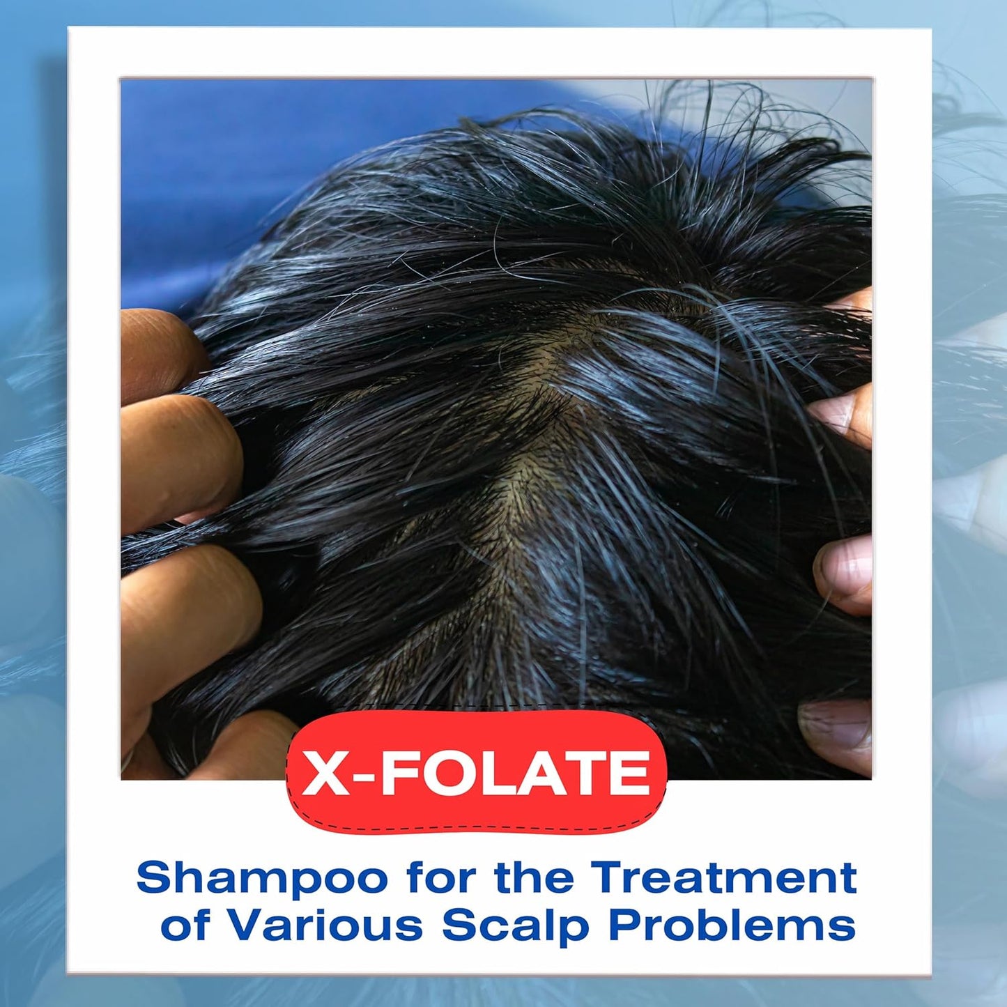 X-Folate Anti-Dandruff Shampoo for Men & Women | Persistent Control for Flaky Scalp - 8.45 oz/250ml