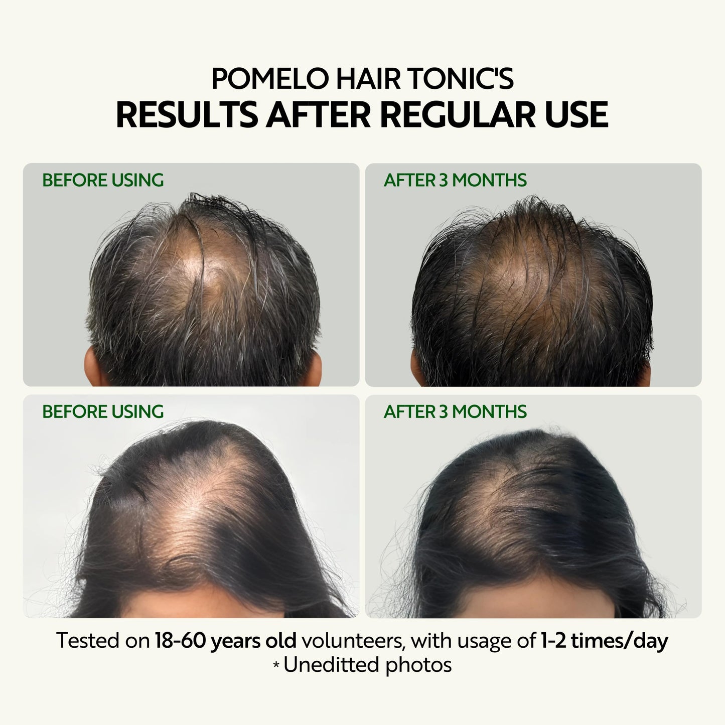 Cocoon Original Vietnam Pomelo Hair Tonic 140ml / 4.73 fl oz – Lightweight Scalp Serum for Thinning Hair, Hydrating, Strengthening & Anti-Breakage with Vitamin B5 & Baicapil