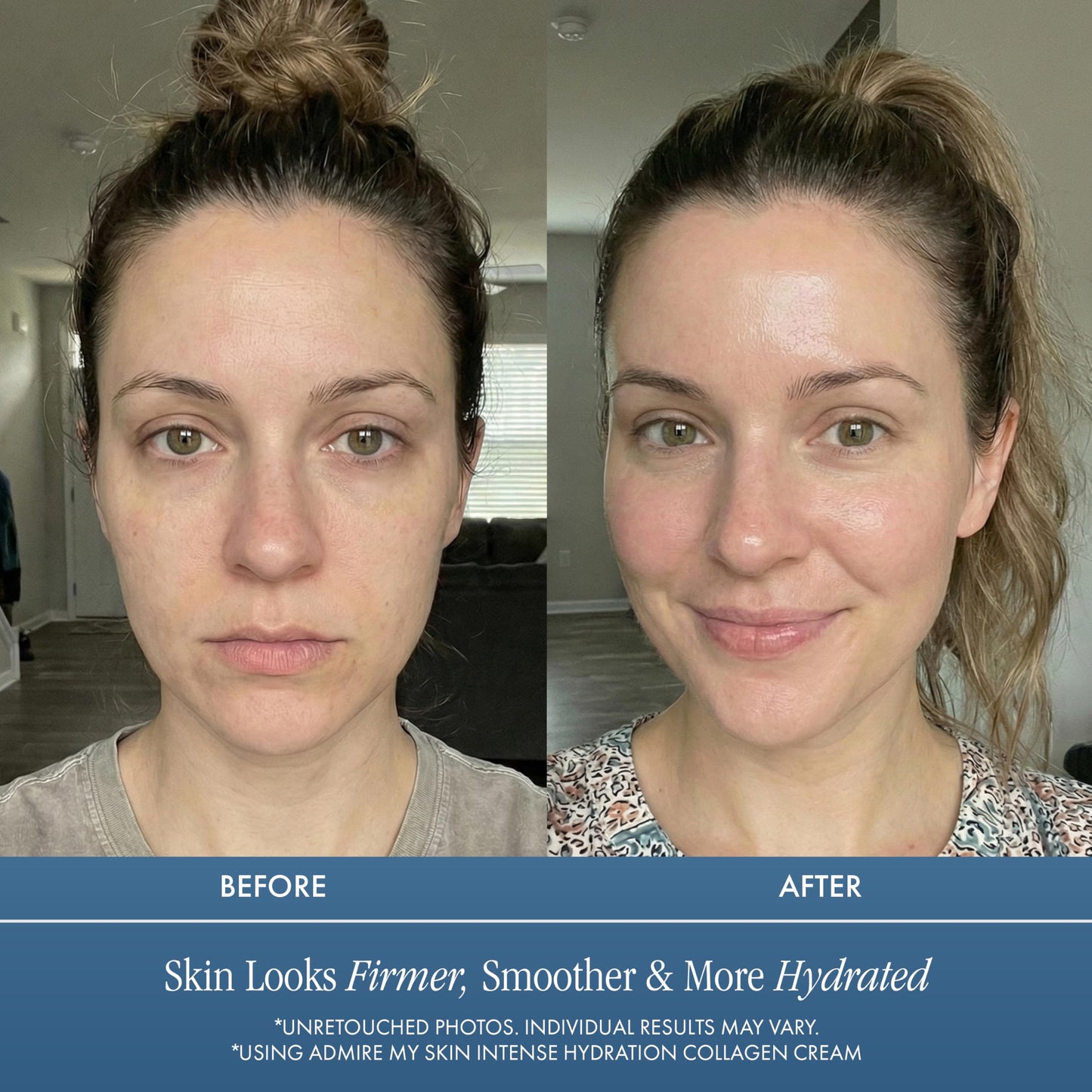Oil Free Face Moisturizer - This Powerful Hyaluronic Acid Cream Face Lotion Is Light, Hydrating, Won't Clog Pores & Will Provide You With That Healthy Youthful Glow (2oz)