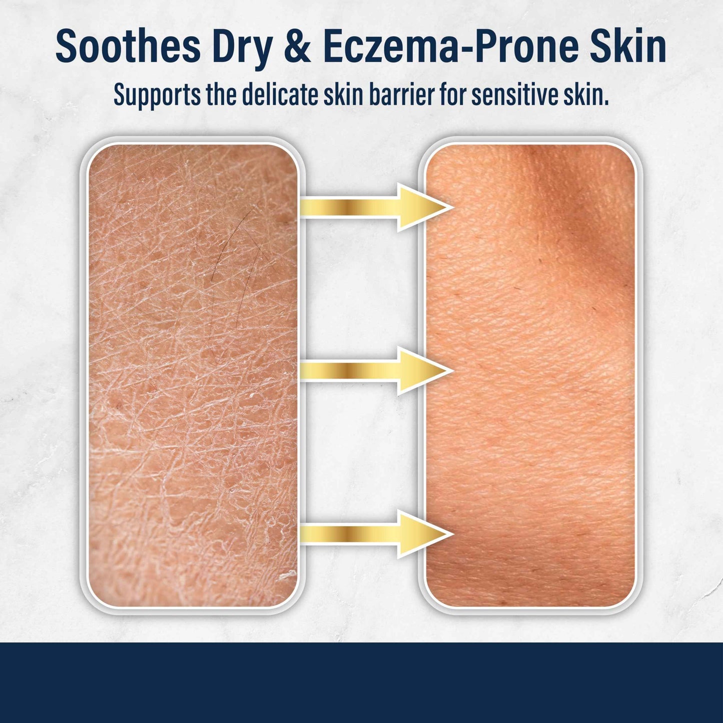 Dr. Eddie's Dermal Defense Moisturizing Cream - Face and Body Moisturizer for Dry Skin, Daily Cream for Sensitive Skin Care, Ultra Moisturizing Eczema Cream for Men and Women - 12 fl oz