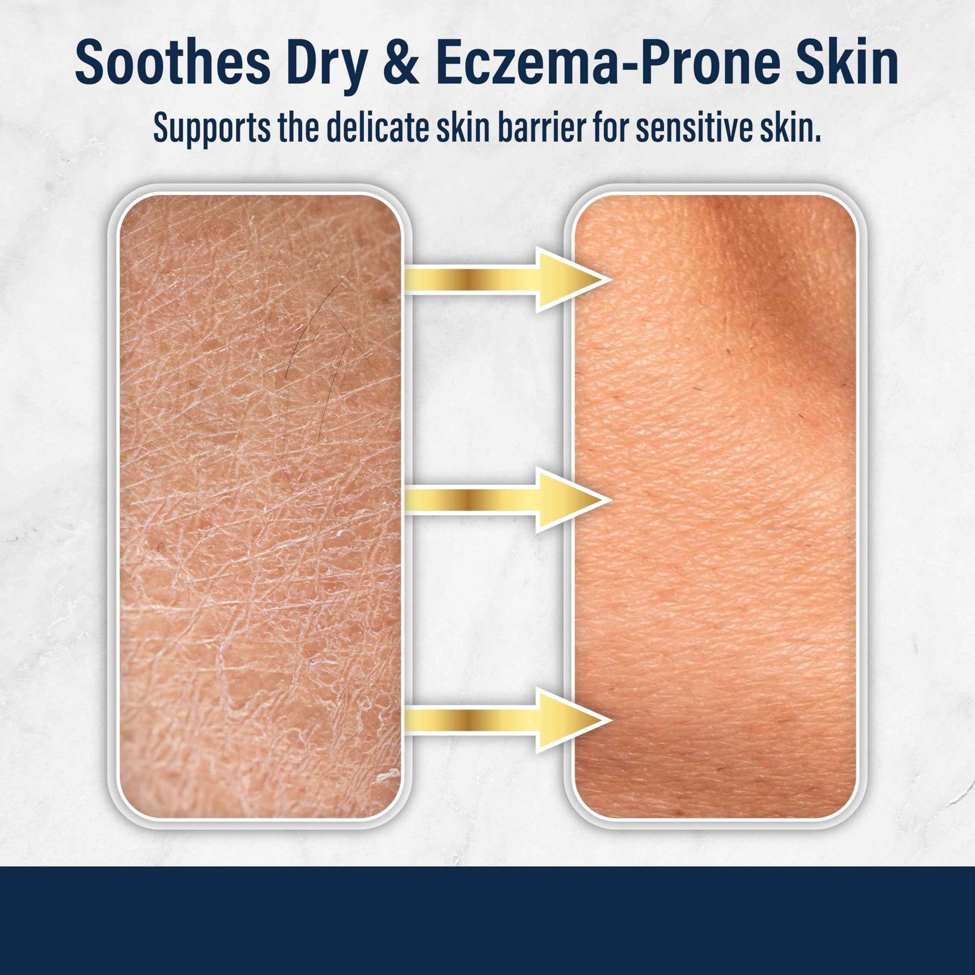 Dr. Eddie's Dermal Defense Moisturizing Cream - Face and Body Moisturizer for Dry Skin, Daily Cream for Sensitive Skin Care, Ultra Moisturizing Eczema Cream for Men and Women - 12 fl oz