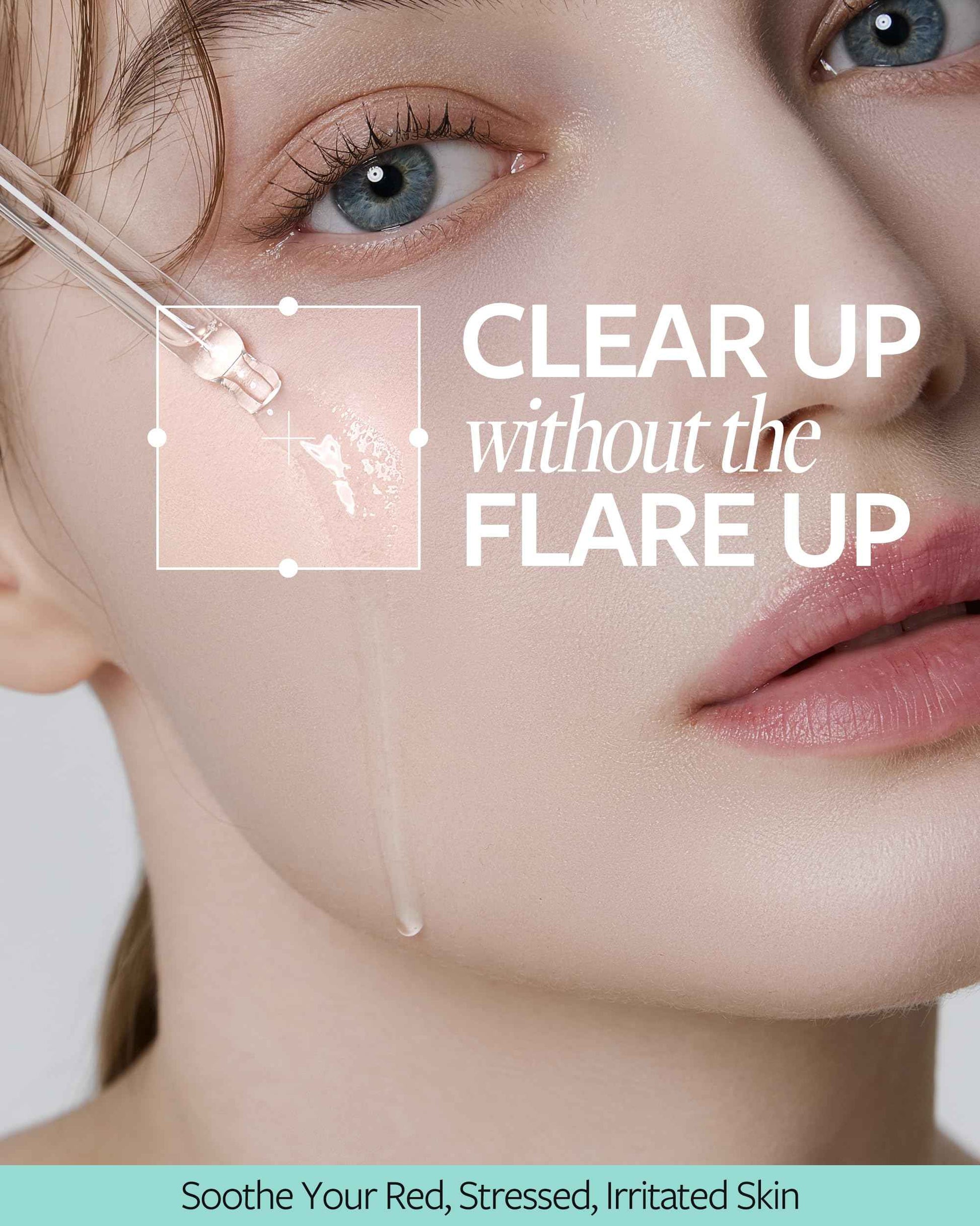 RECIPE Azelaic Acid 10 Soothing Ampoule - Soothing Serum, Facial Serum for Sensitive skin - Korean Skincare for Mild Breakouts (1.01 fl oz)