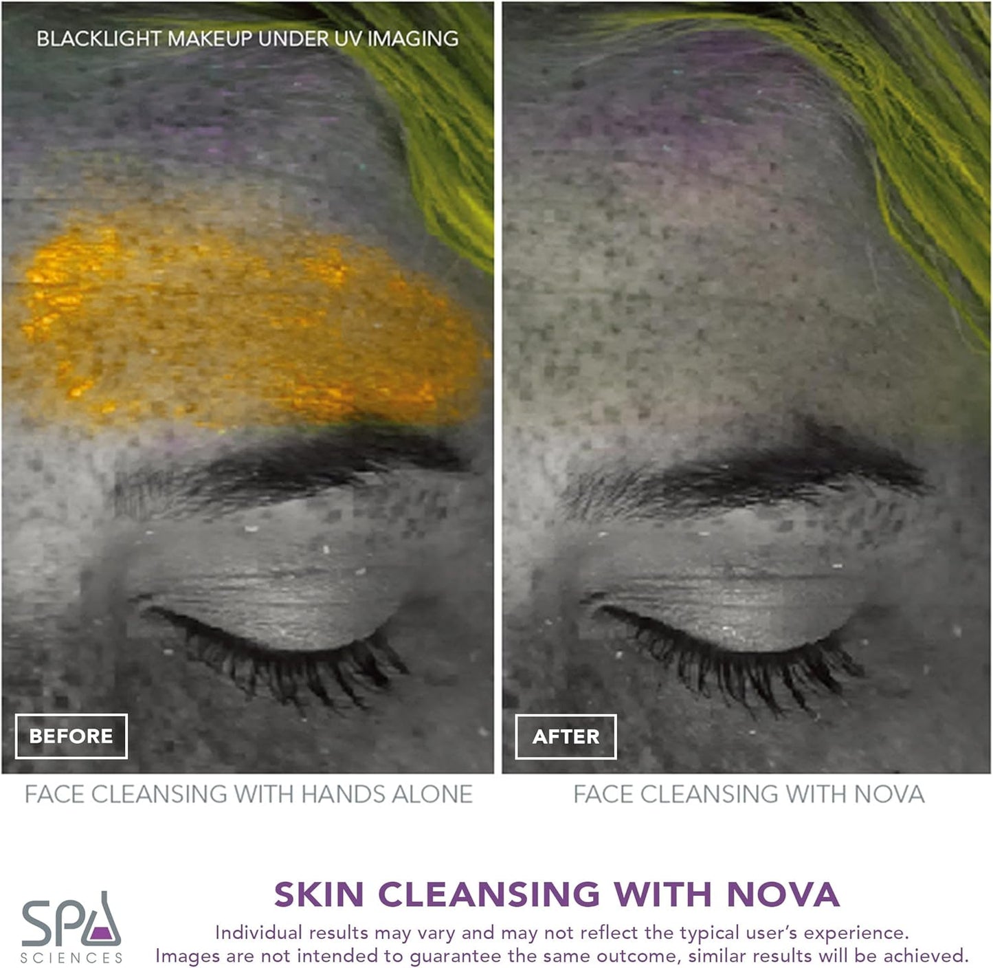 NOVA Sonic Cleansing Brush - Anti-Aging Exfoliating Facial Tool | Waterproof, USB Rechargeable