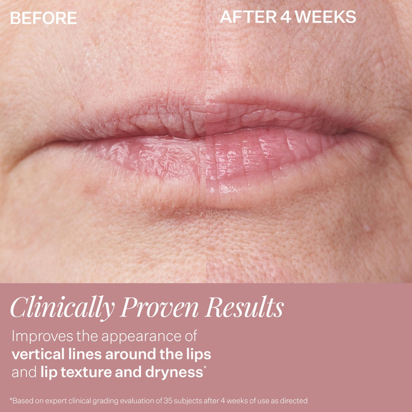 StriVectin DoubleFix for Lips 2-in-1 Lip Fix Plumping Treatment & Vertical Line Treatment