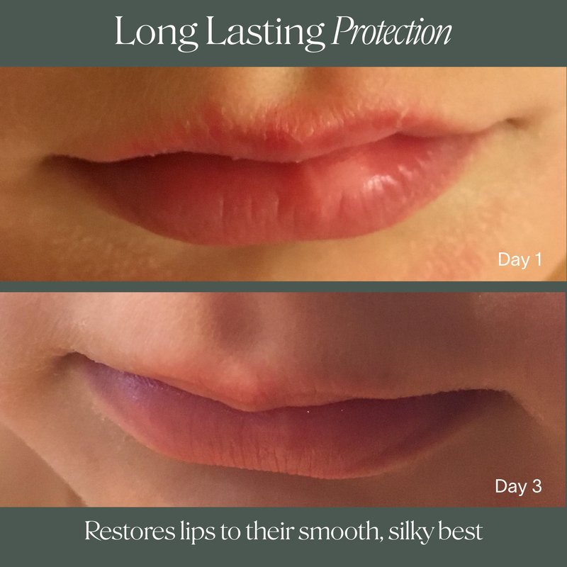 Doctor Rogers Lip Balm, Ultra Hydrating Lip Treatment, Clean Fragrance-free Lip Moisturizer for Soft Lips, Hypoallergenic, 0.15oz (4.25g), Pack of 3 Tubes