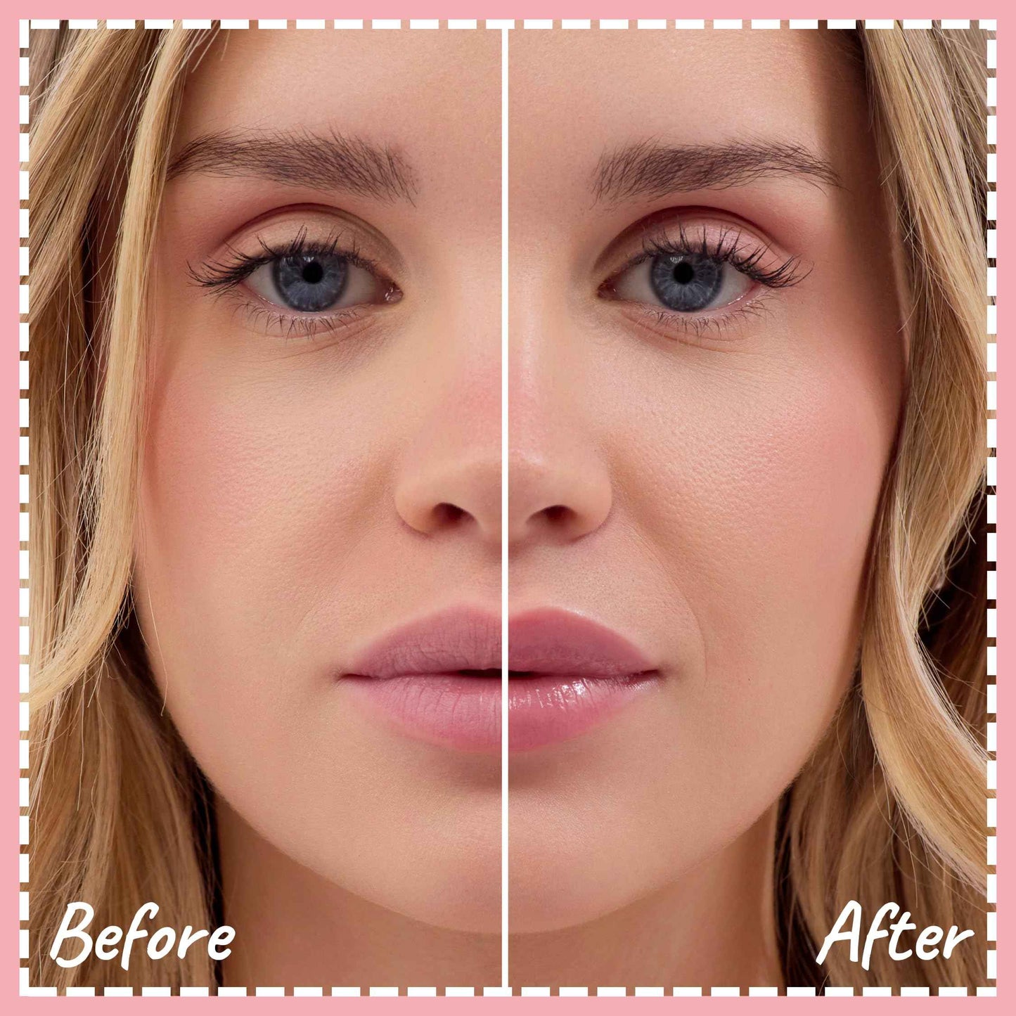 Crickle Daisy Lip Treat Balm - Hydrating & Nourishing Lip Balm with Avocado, Olive, and Coconut Oils - Softening Lip Moisturizer & Protection for Very Dry Lips - Sugar Blossom Scented, 0.7oz