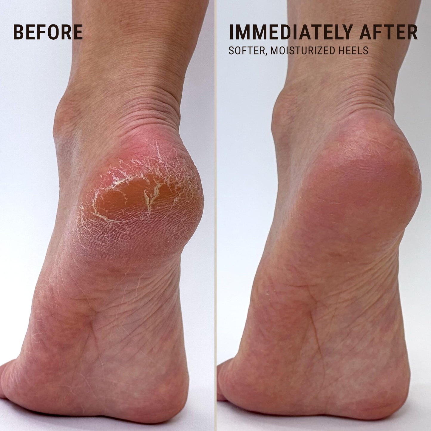 VOESH Heel Repair Duo, Solemate Heel Repair Balm & Moisturizing Heel Socks, Cracked Heel Stick Balm, Foot Care for Men & Women, at-Home Foot Care, K-Beauty Korean Skincare - Lavender