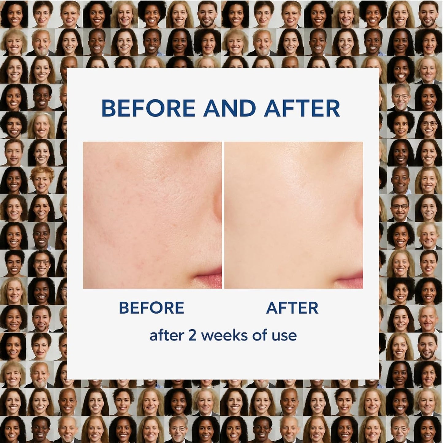 Alpha Skin Barrier Cream - Moisturizing Lotion for Dry, Sensitive Skin | 80ml Face & Body Care