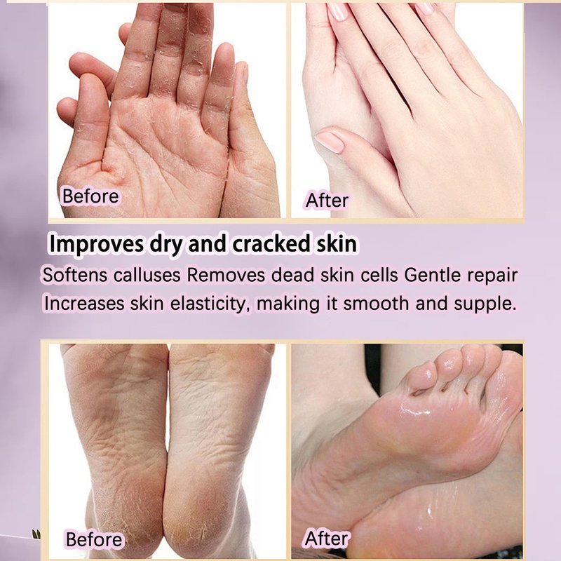 BACTIBLAST Paraffin Wax Gloves,The Paraffin Wax for Hand and Feet,Paraffin Hand & Foot Treatments and Booties Set for Intensive Hydration At Home Or Spa(Lavender) 2 Pair Hand & Foot Wax Gloves