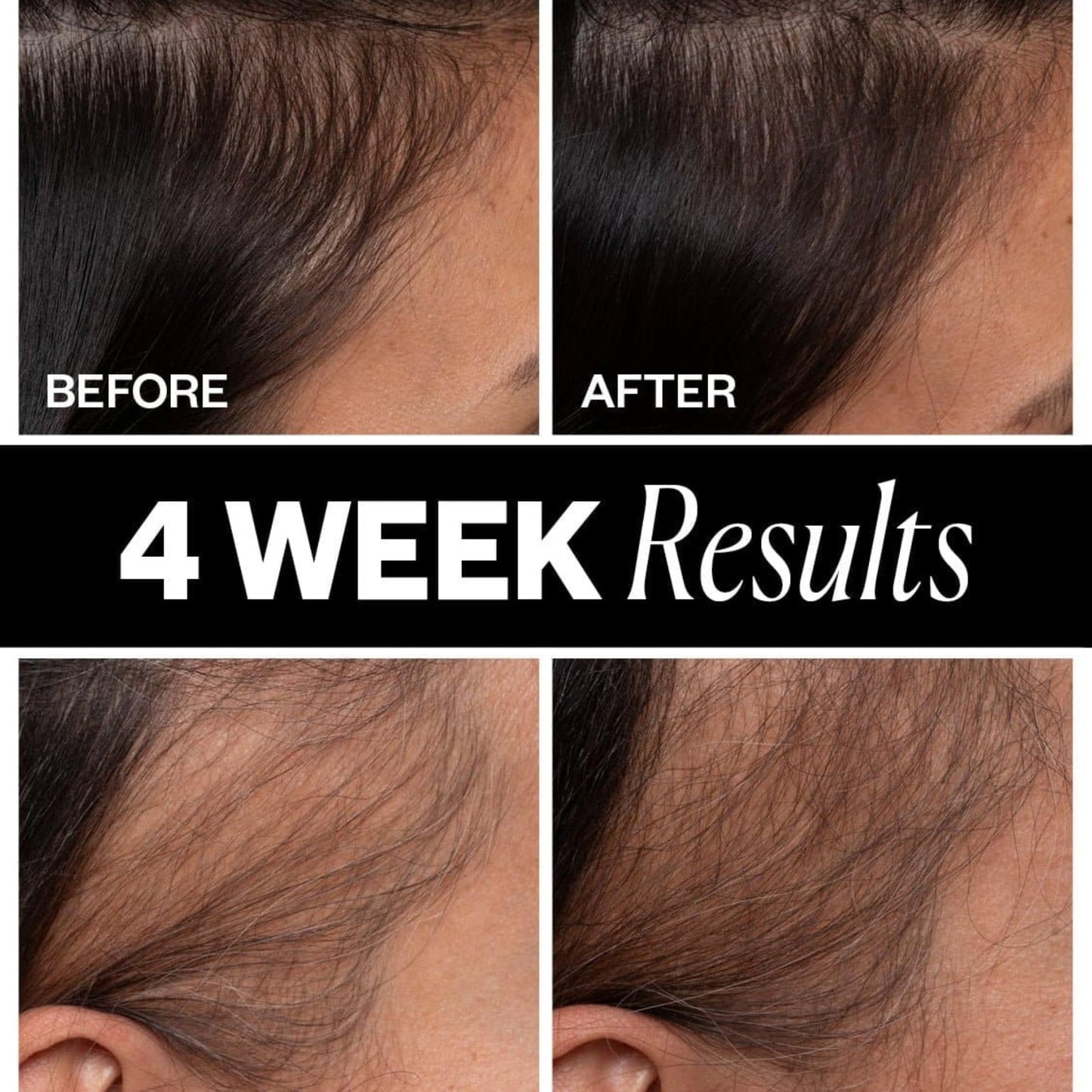 IGK SPONSORED Scalp Treatment for Hair Growth | Thickening Serum for Thinning Hair | Clinically Tested Mist for Hair Density and Volume | 2.1 Oz
