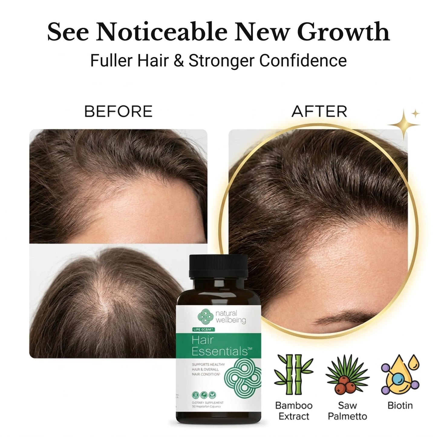 Natural Wellbeing Hair Essentials – DHT Blocker Hair Growth Supplement for Women & Men – Saw Palmetto, Biotin, – Vegan Capsules – Stops Shedding & Thinning (90 Count, 1-Month Supply)