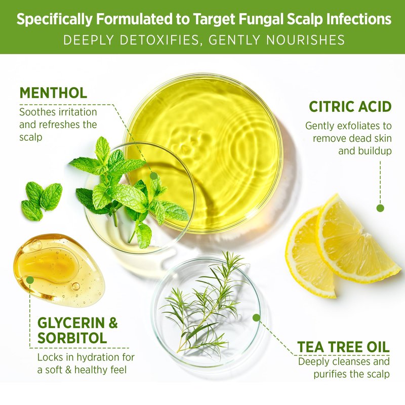 Roycederm Tea Tree Scalp Scrub – Pre-Shampoo Exfoliating Treatment for Dry, Flaky Scalp – Deep Cleansing, Refreshing & Balancing Formula for Healthy-Looking Hair