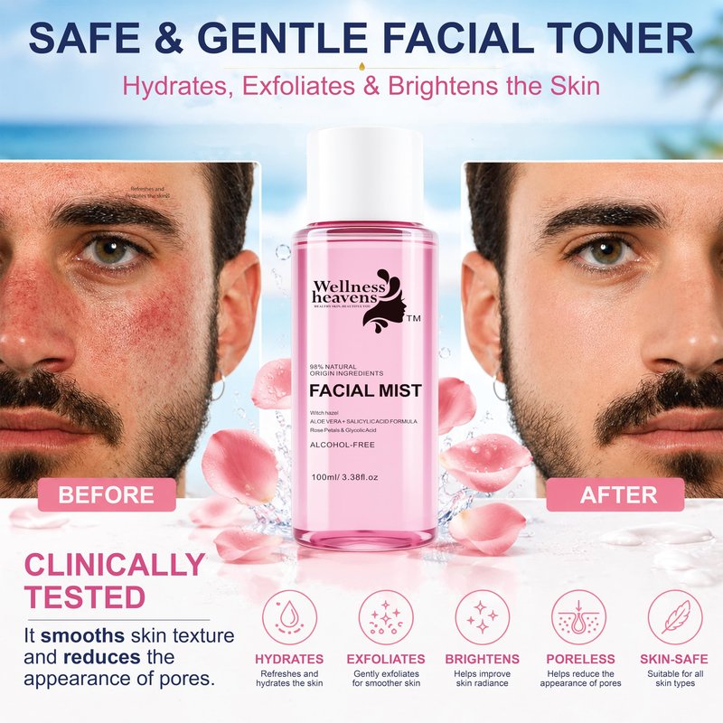Hydrating Witch Hazel Face Toner with Aloe Vera & Glycolic Acid – Rose Petal Pore Minimizing Facial Toner for Acne Prone Skin, Blackheads, Oily & Combination Skin – Alcohol Free Daily Glow Toner 100ml