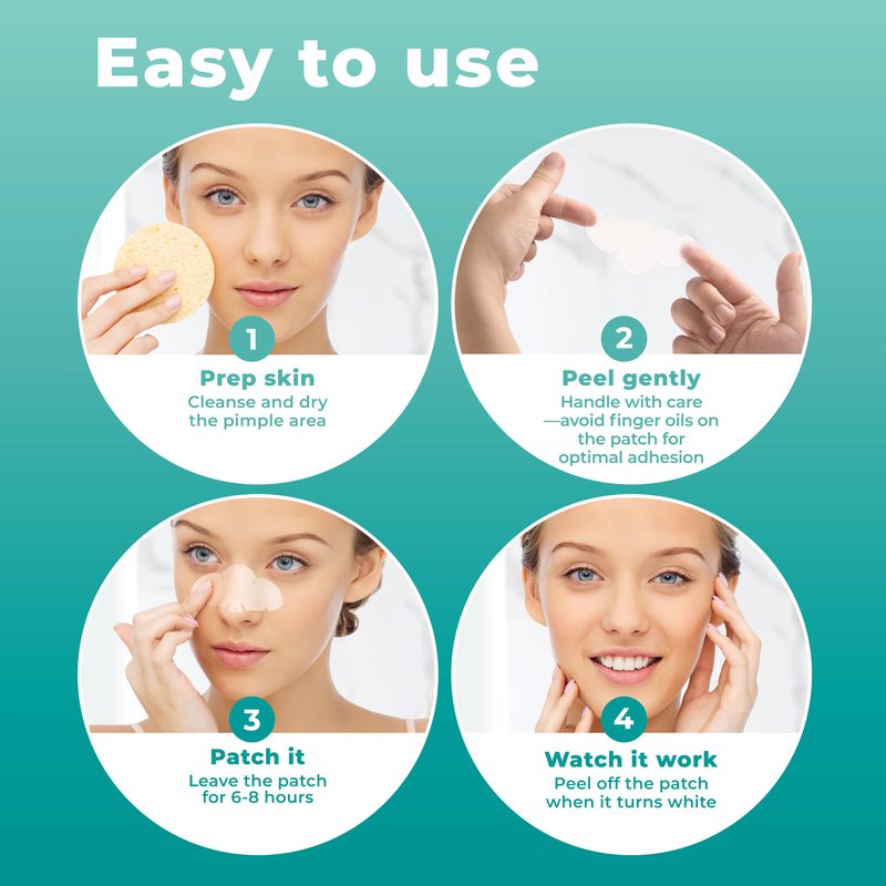 PatchRx Pimple Patches for Nose (12 Pack), Cover Nose Pimples - Hydrocolloid Acne Patches - Pimple Patch Hydrocolloid Patches & Pimple Stickers, Nose Strip, Zit Patches