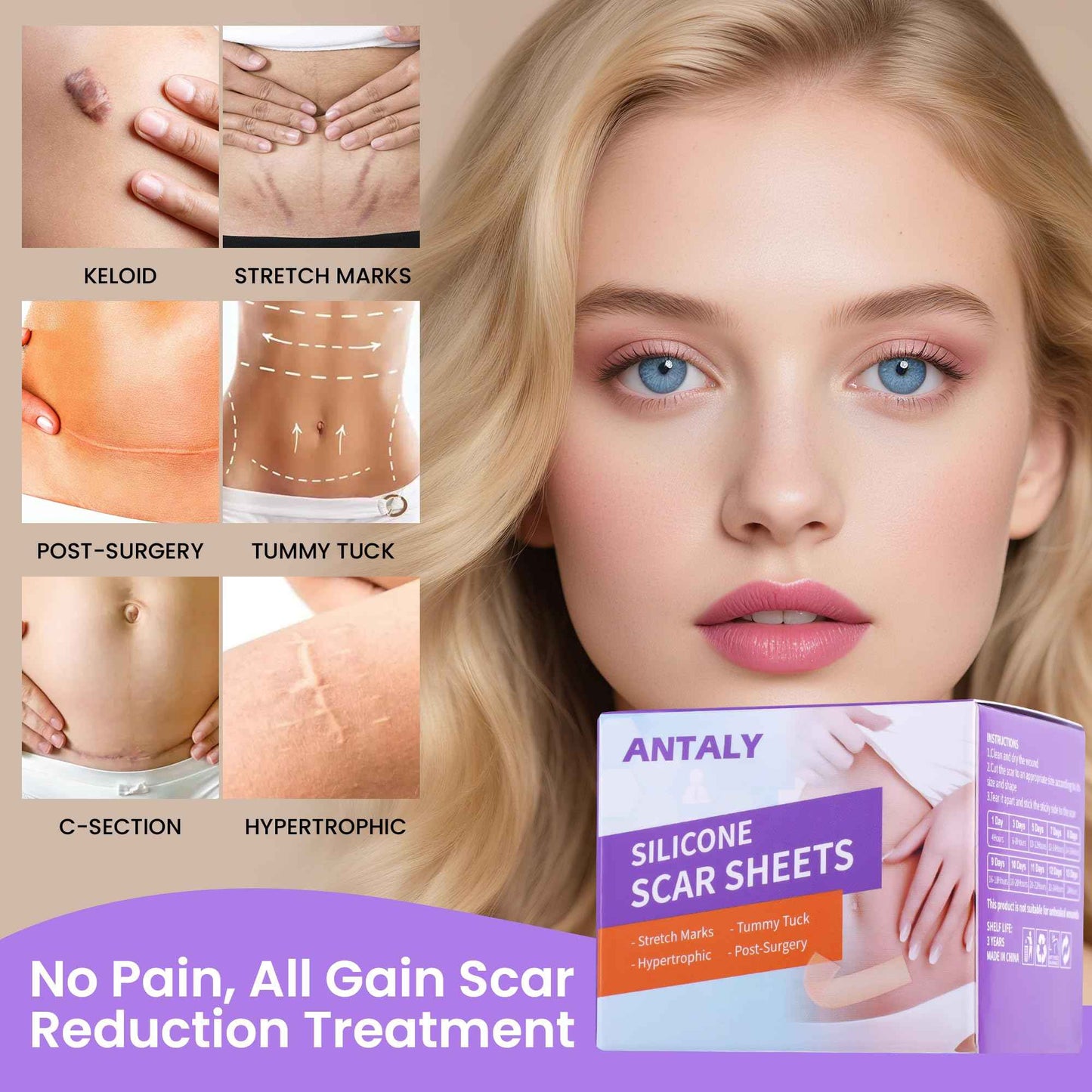 Antaly Silicone Scar Sheets, Silicone Scar Tape, Medical Grade Skin Patches for Surgical Scars, Keloid Bump Removal, C-Section, Stretch Marks, Hypertrophic, Post-Surgery-1.6"X 79" Roll, 2M