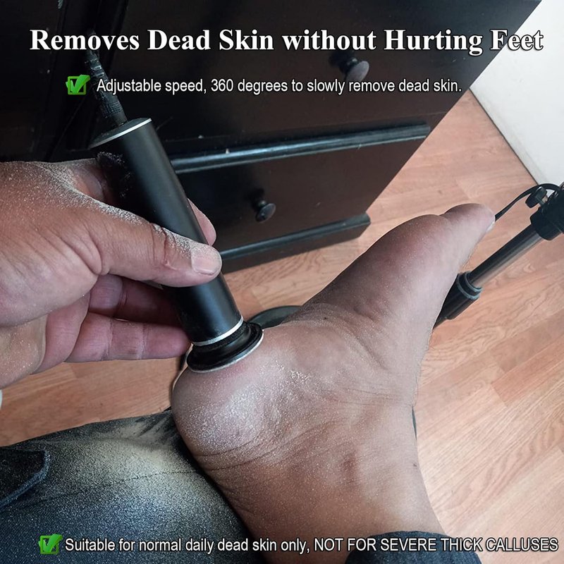Electric Callus Remover - Adjustable Speed Foot File & Pedicure Tool | 60 Replaceable Sandpaper Discs, Black