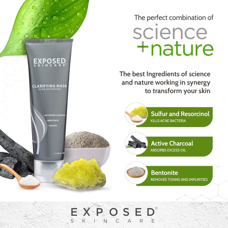 Acne Treatment Mask - 3% Sulfur & Activated Charcoal | Oil Control for Teen & Adult Acne