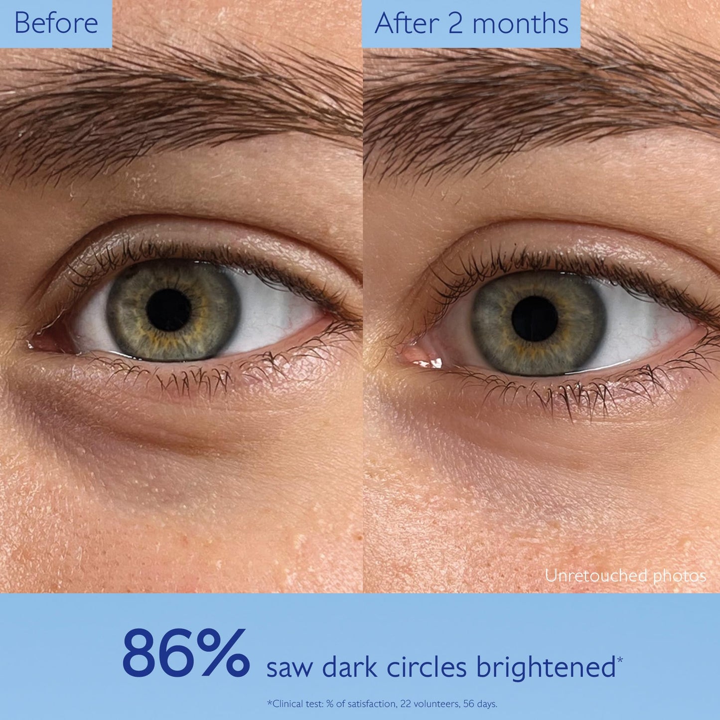 Caudalie Vinoperfect Dark Circle Brightening Caffeine Eye Cream with Niacinamide, Fragrance Free - 15 mL