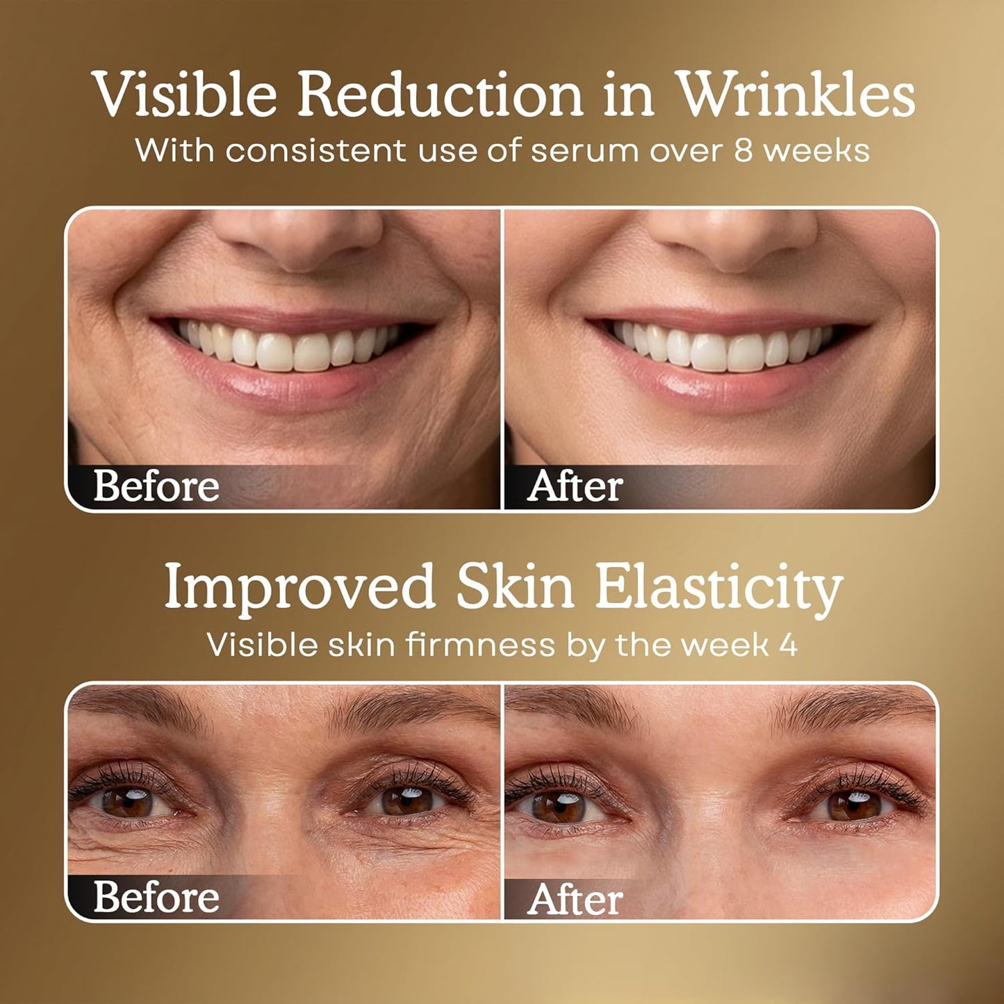 Anti-Aging Serum with Matrixyl 3000 & Hyaluronic Acid - Deep Wrinkle Repair & Hydration | 1.01 Fl Oz