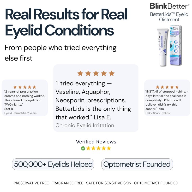 BlinkBetter BetterLids Eyelid Ointment for Dry, Itchy & Sensitive Eyelids – Deep-Moisturising Oat Complex with Shea Butter & Panthenol to Hydrate, Nourish & Soothe Delicate Eyelid Skin – 0.34 oz