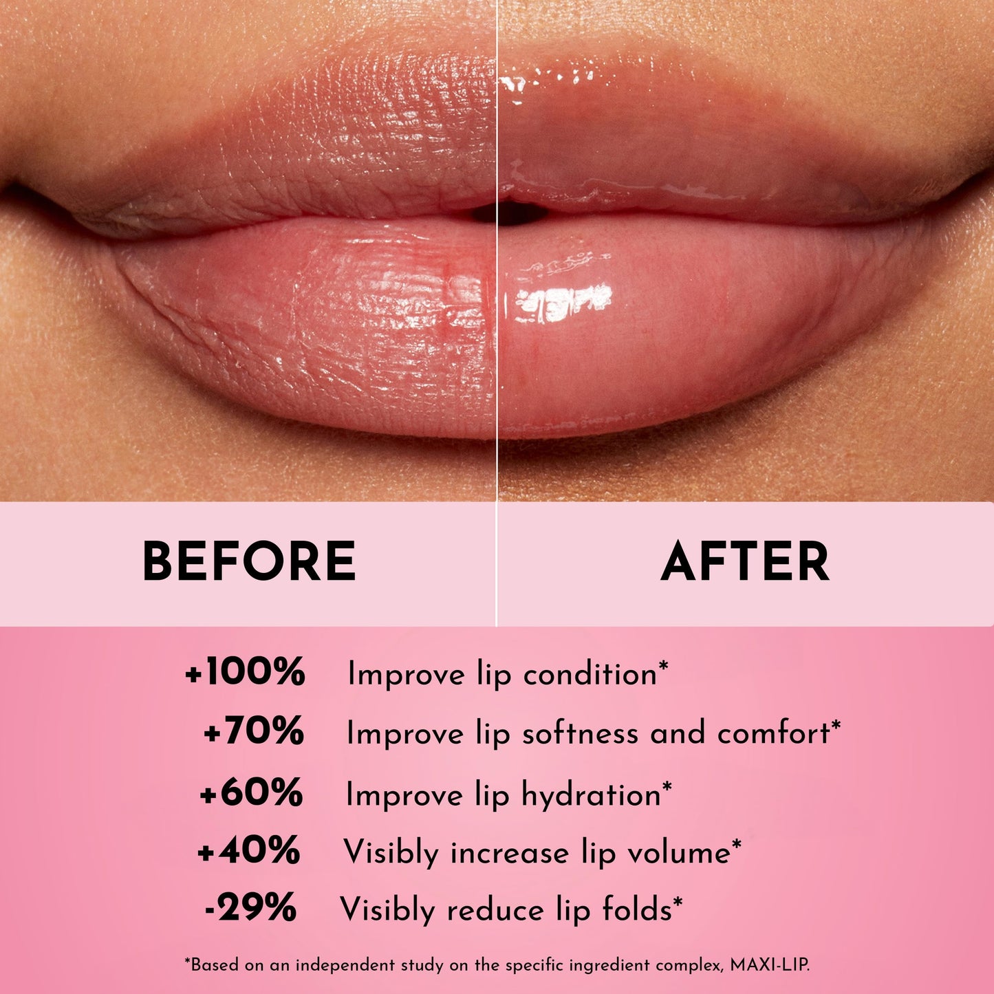 LAWLESS Forget the Filler Lip Mask - Sweet Dreams - Premium Overnight Lip Plumping Treatment with Natural Ingredients Designed to Plump, Hydrate, and Smooth Lips - 0.28 oz