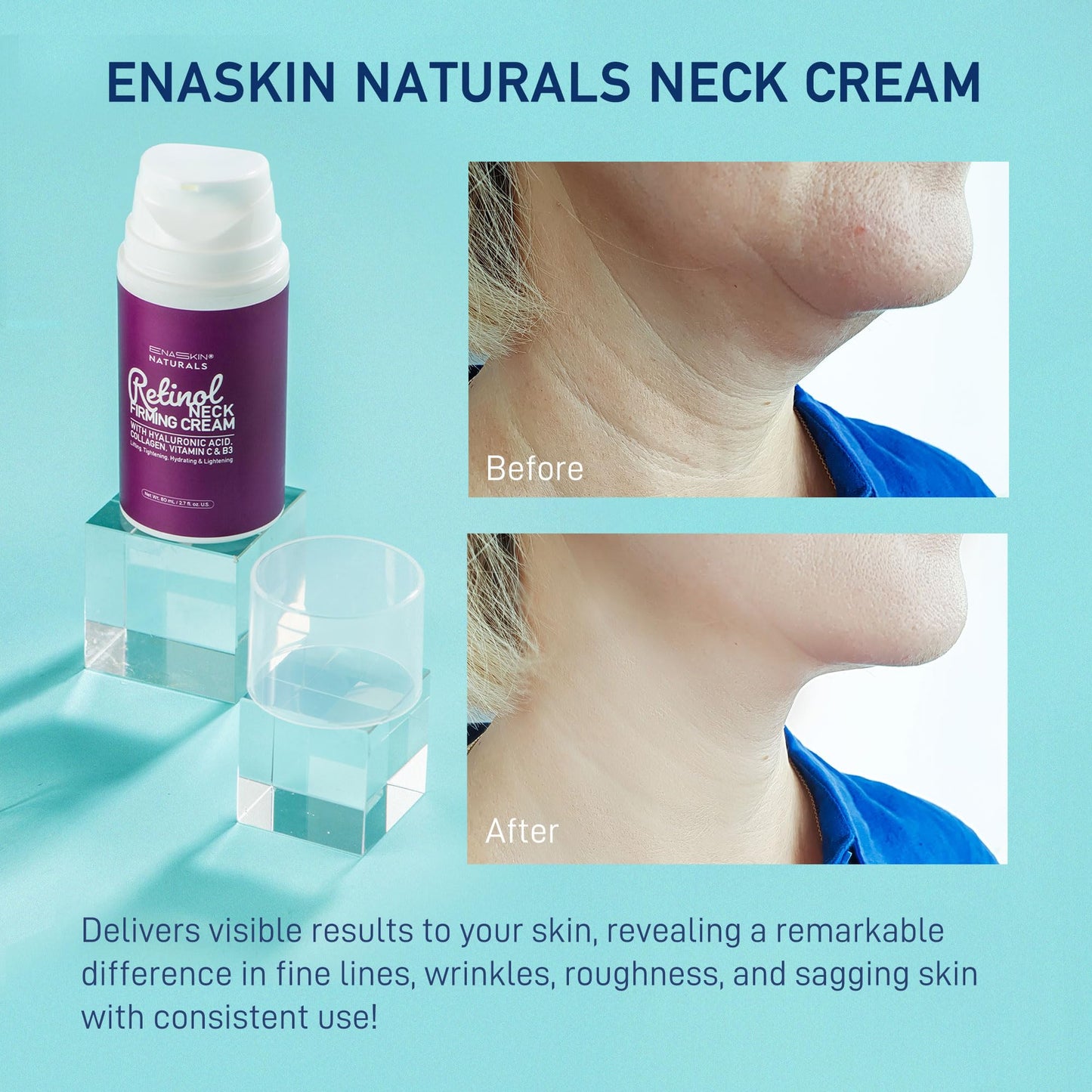Advanced Neck & Face Firming Cream with Retinol, Hyaluronic Acid & Collagen: Targets Wrinkles, Sagging, and Loose Skin for a Youthful Lift - 2.7 Oz