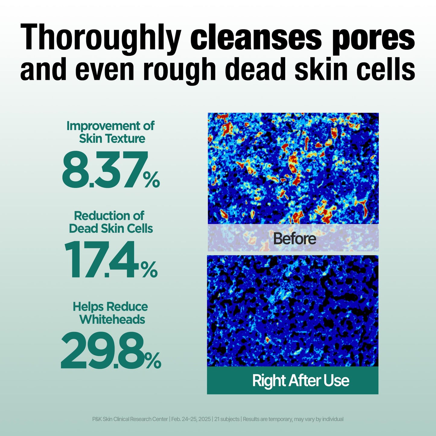 DERMATORY Salicylic™ Pore Cleansing Clay Foam | Deep Purifying for Facial Oil, Sebum, Dead Skin Cells, Whiteheads & Blackheads | Gentle Exfoliating Korean Face Wash for Sensitive | 5.07 fl. oz.