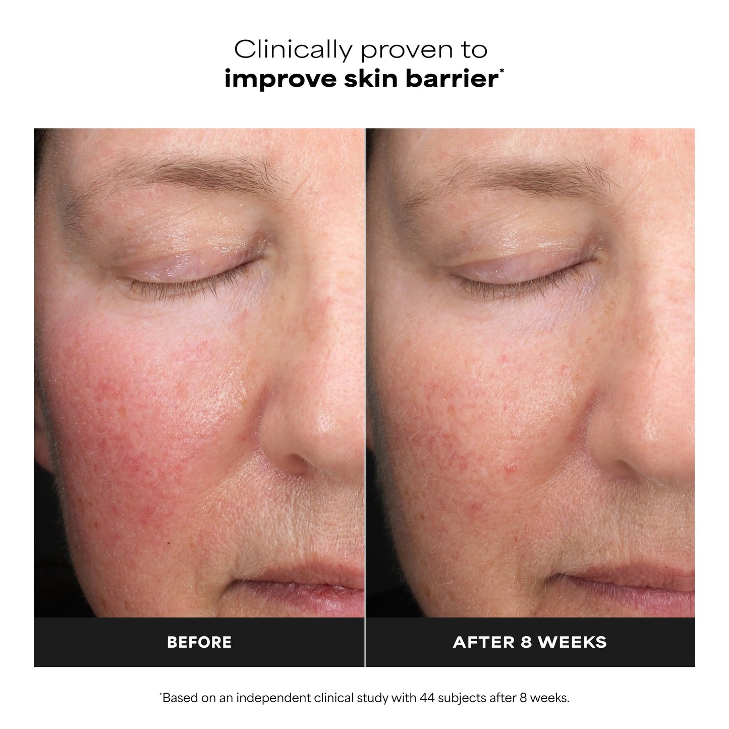Paula’s Choice 6% Mandelic Acid + 2% Lactic Acid Exfoliant, Gentle Daily AHA Exfoliation for Discoloration, Bumpy Texture & Radiance, for Sensitive Skin, Fragrance-Free, 3 Fl. Oz.