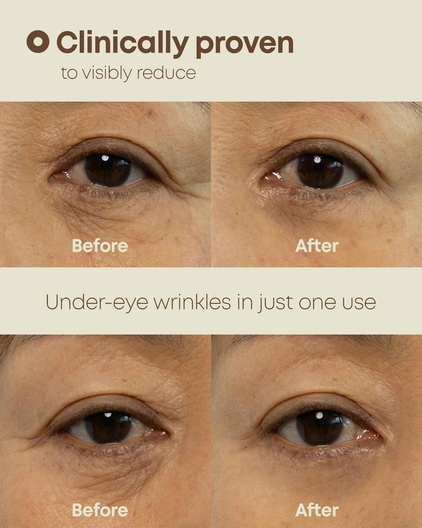 NINELESS Ever-Youth Dual Effect Eye Cream Korean Skincare Instant Lifting Technology for Firm Eyes with Niacinamide Adenosine Hyaluronic Acid Ceramides for Fine Lines Bags Puffiness 0.5 fl oz