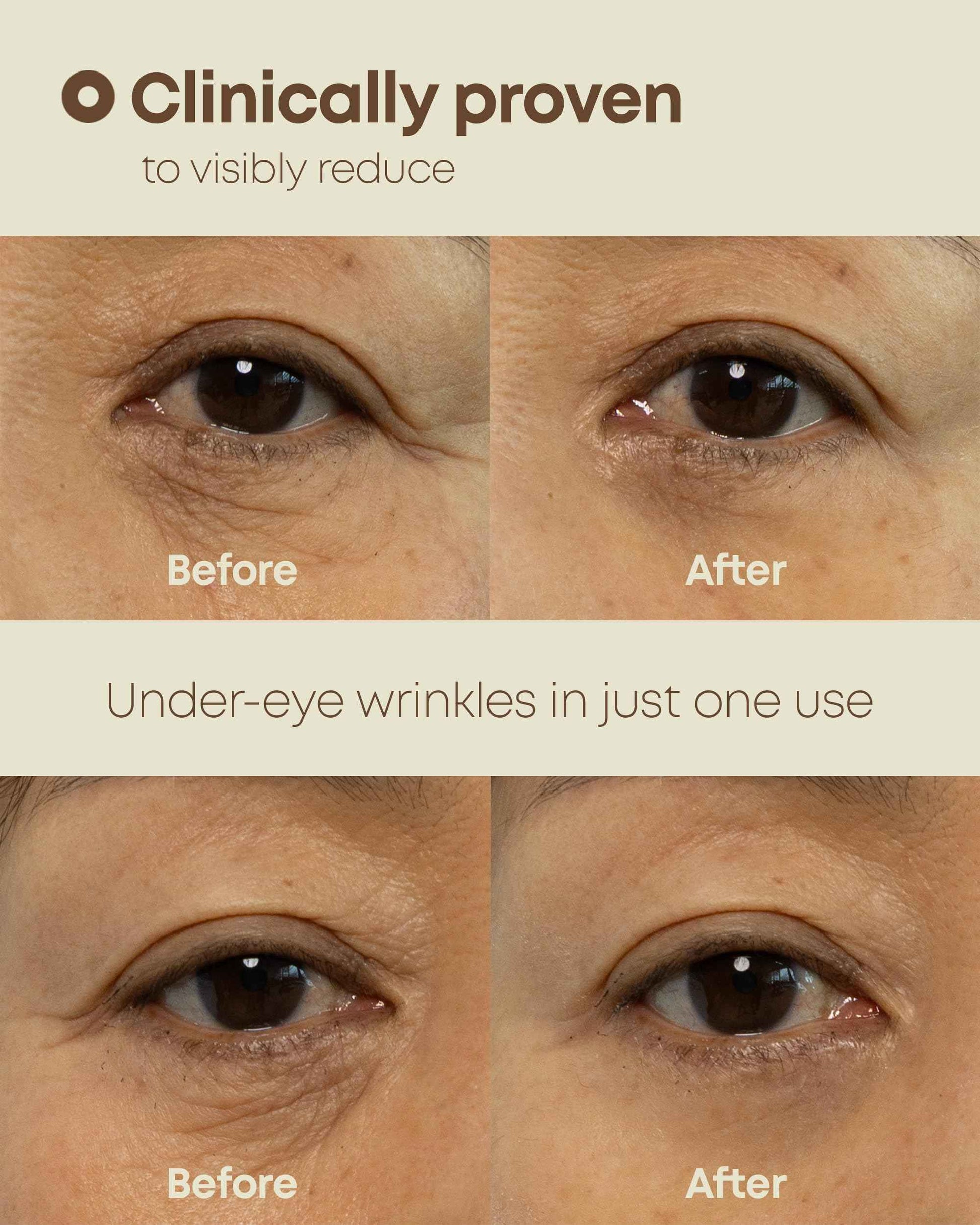 NINELESS Ever-Youth Dual Effect Eye Cream Korean Skincare Instant Lifting Technology for Firm Eyes with Niacinamide Adenosine Hyaluronic Acid Ceramides for Fine Lines Bags Puffiness 0.5 fl oz