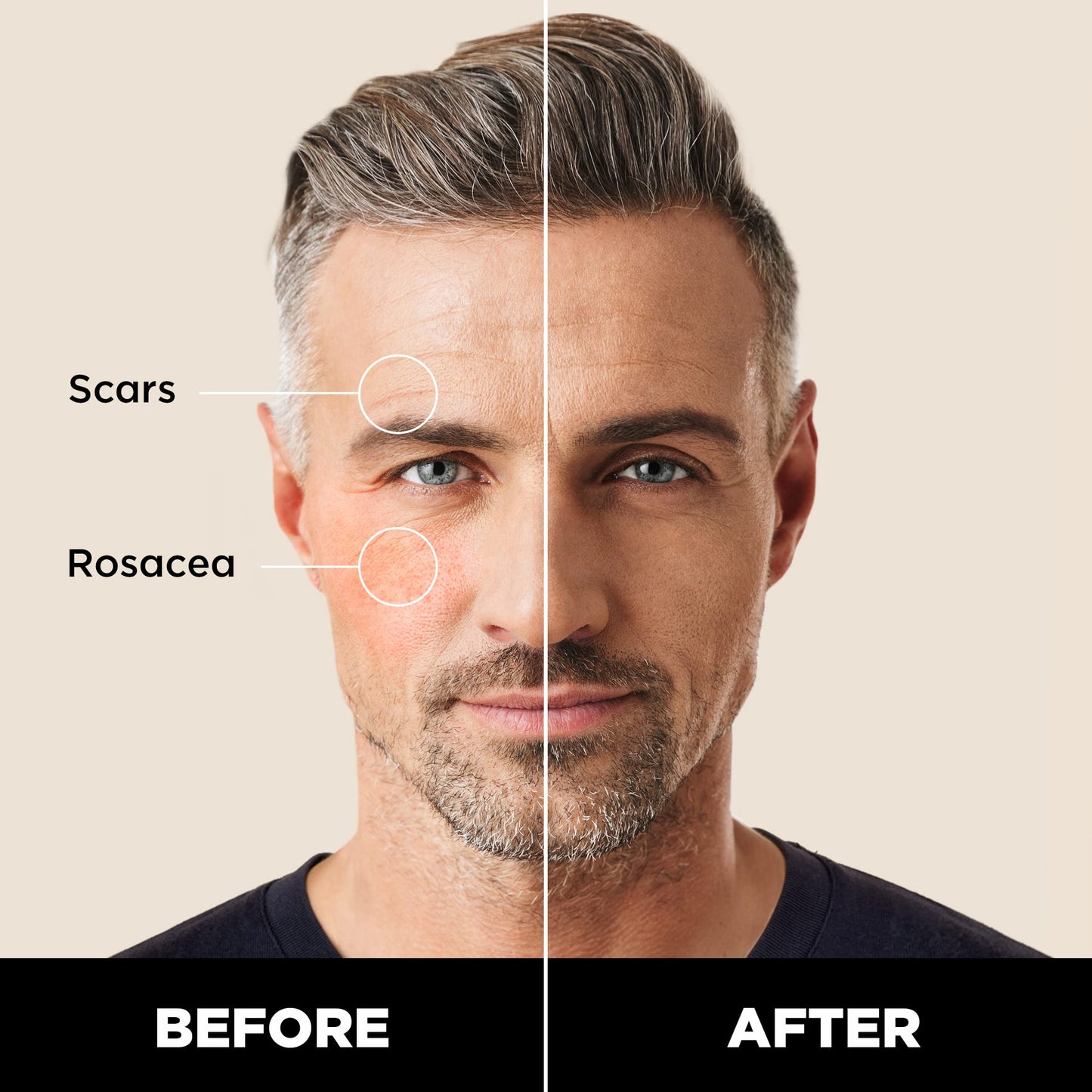 Stryx Concealer Stick Tool for Men, Medium Mahogany - Natural Pigments Hides Imperfections, Acne, Razor Burns, Scars, & Rosacea - Highly Adaptable Shades for Easy, Undetectable Coverage