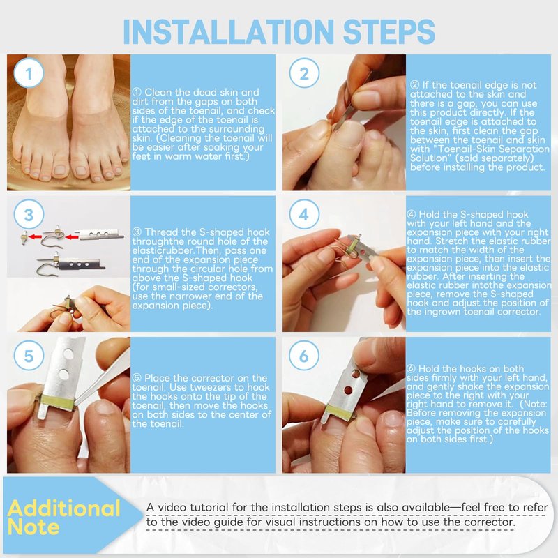 InhwRior Ingrown Toenail Corrector, Easy At-Home Application, Secure Fit (No Slipping Off), Steady Traction for Rapid Pain Relief, Waterproof for Shower & Swimming(0.83" to 0.91" Toenail Length)