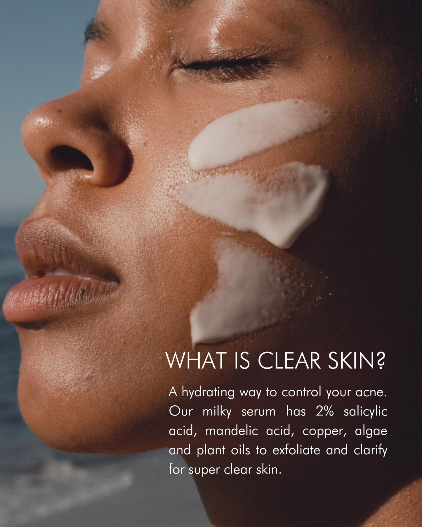 MARA Clear Skin Mineral Milk - 2% Salicylic Acid BHA Acne Treatment (1 oz)