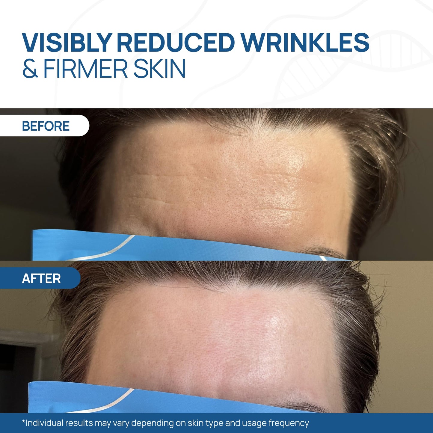 Welaroise Bio Protein Collagen Hydrogel Deep Face Mask +35% More Collagen, Intense Hydration & Moisturization, Firming, Anti-Aging, Skin Renewal, Korean Skincare (Pack of 16)