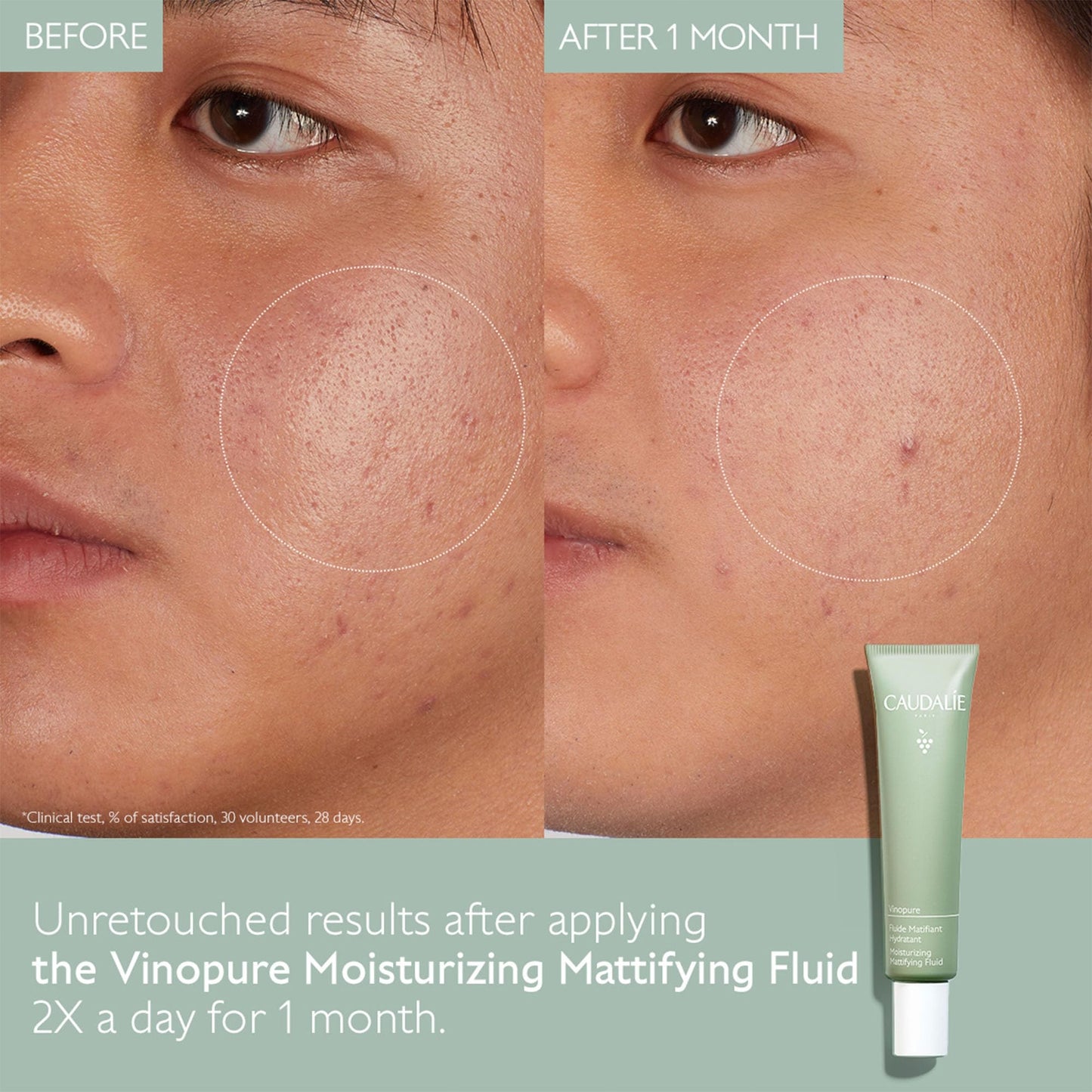 Caudalie Vinopure Oil Control Moisturizer, Hydrating & Mattifying Moisturizer - 40 mL